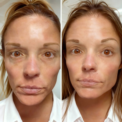 Roll-On Moisturizing Serum