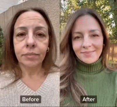 3. Visible Improvements Start Quickly, And Only Get Better With Time