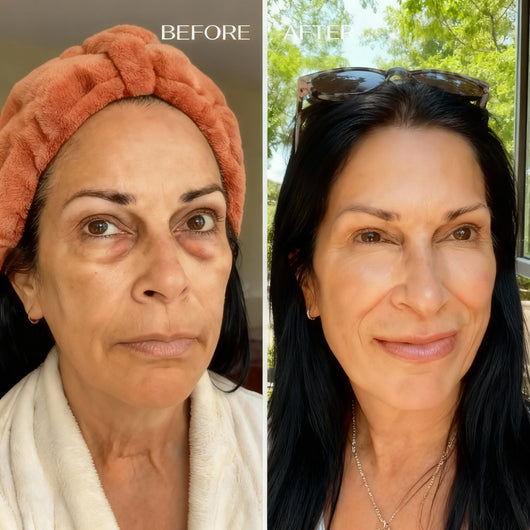 BrightEye Roll-on Moisturizer