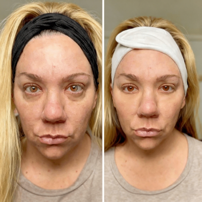 Roll-On Moisturizing Serum